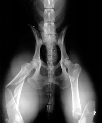 Zlomeniny-stehennich-kosti